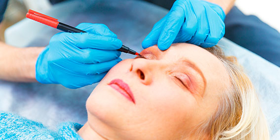 Cirurgia de plástica palpebral (blefaroplastia)